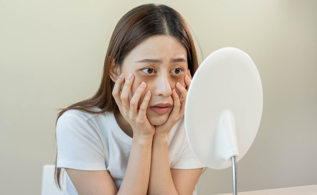 ডার্ক সার্কেল হবার কারণ সম্পর্কে কতটুকু জানেন?