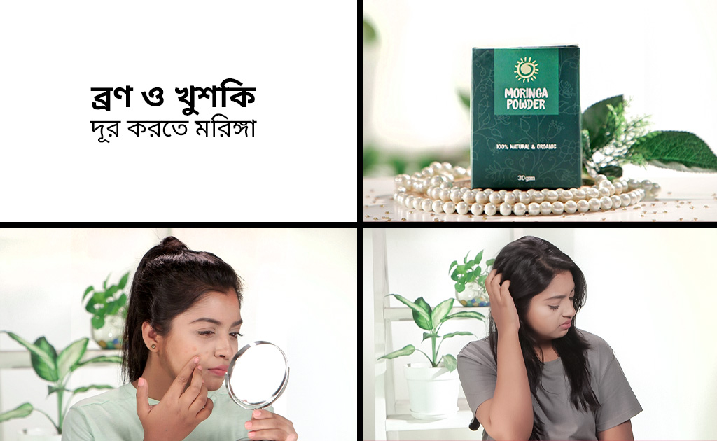 ব্রণ ও খুশকি দূর করতে মরিঙ্গা