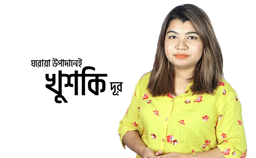 ঘরোয়া উপাদানেই খুশকি দূর করার উপায় জানেন কি?