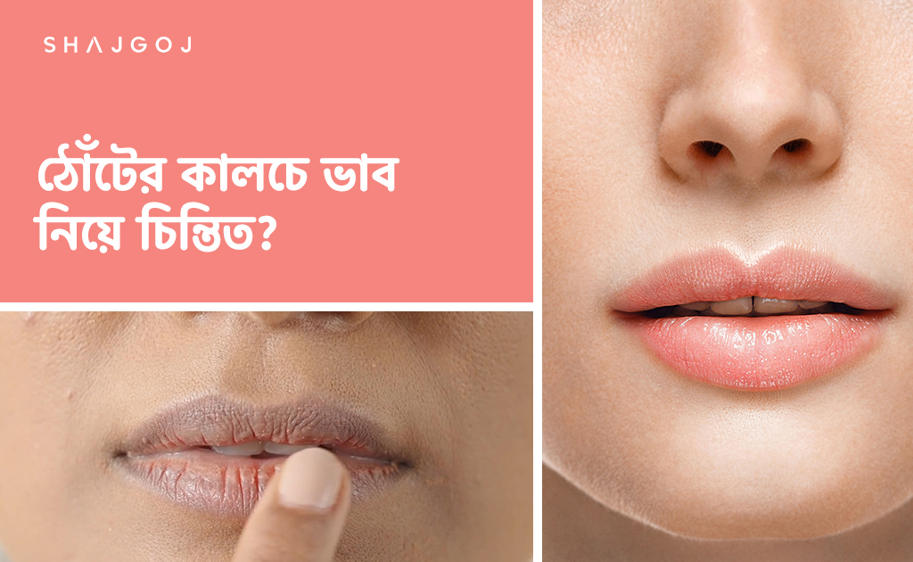 ঠোঁটের কালচে ভাব নিয়ে চিন্তিত?