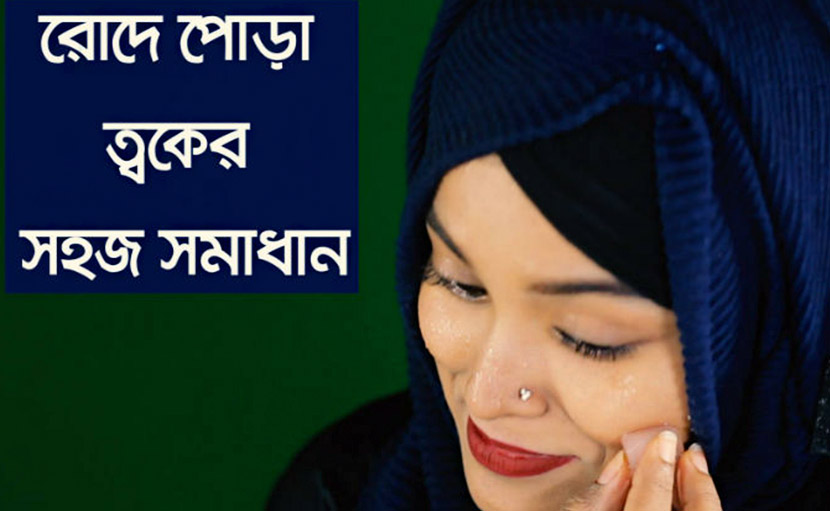 রোদে পোড়া ত্বকের সমাধান হবে খুব সহজে!