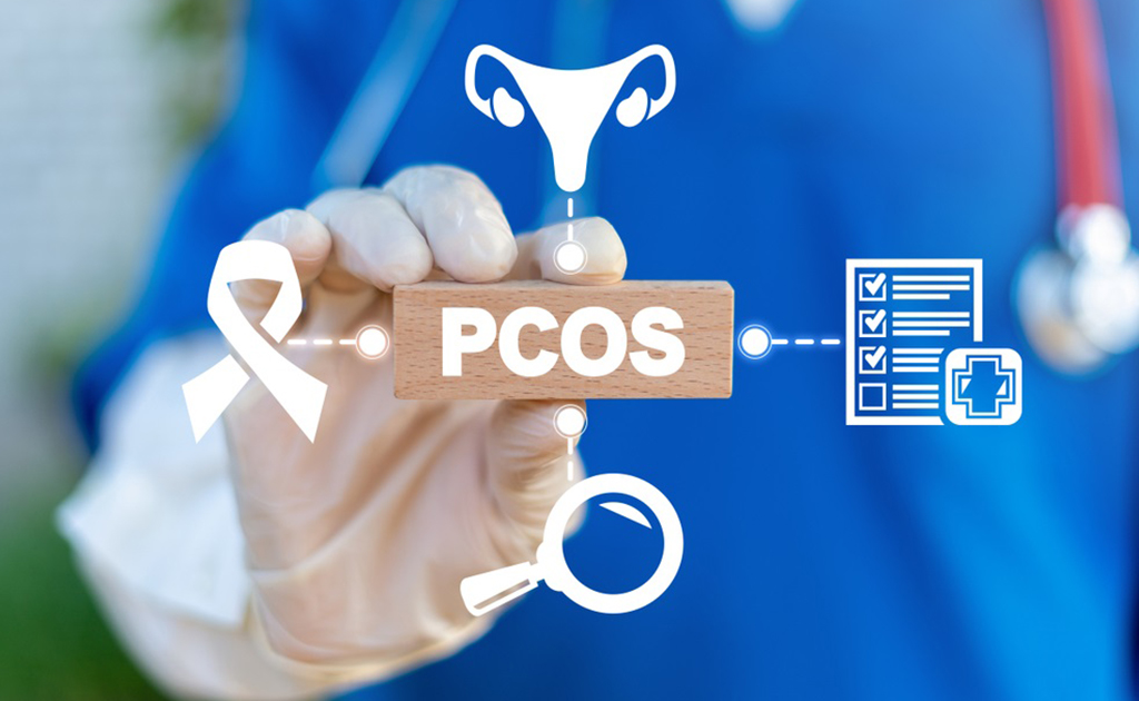 পিসিওএস (PCOS) কী এবং এ রোগে কোন ধরনের খাবার খাবেন?