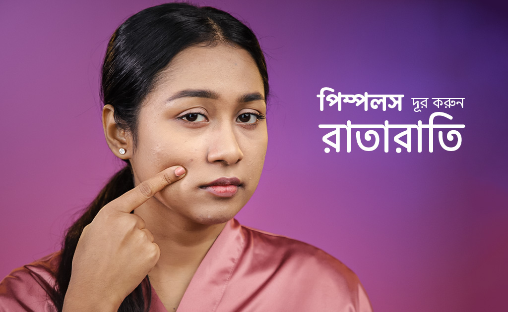 পিম্পলস দূর করুন রাতারাতি!