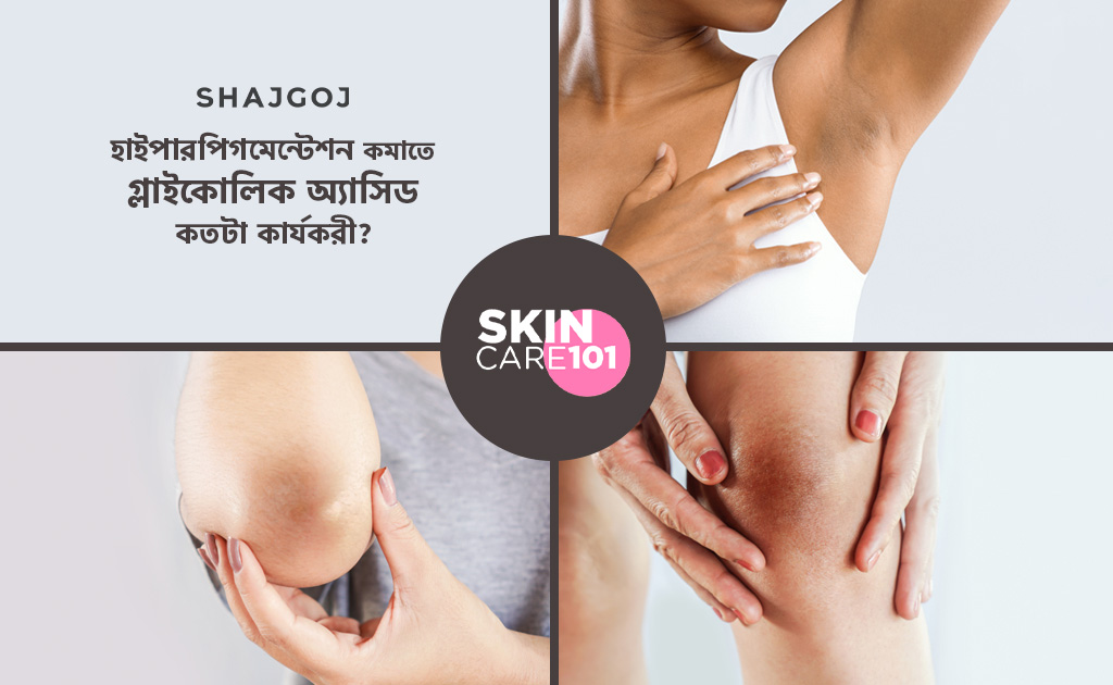 হাইপারপিগমেন্টেশন কমাতে গ্লাইকোলিক অ্যাসিড কতটা কার্যকরী?