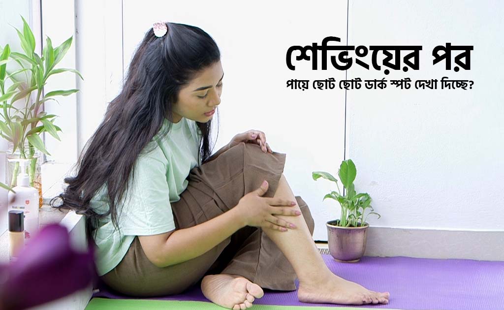 শেভিংয়ের পর পায়ে ছোট ছোট ডার্ক স্পট দেখা দিচ্ছে?