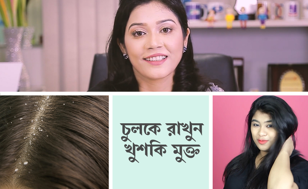 চুলকে রাখুন খুশকি মুক্ত
