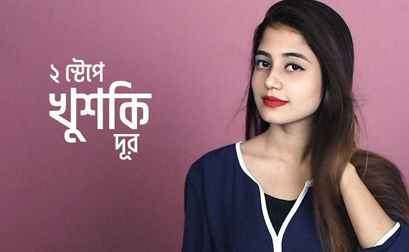 ২ স্টেপে খুশকি দূর করুন সহজেই!