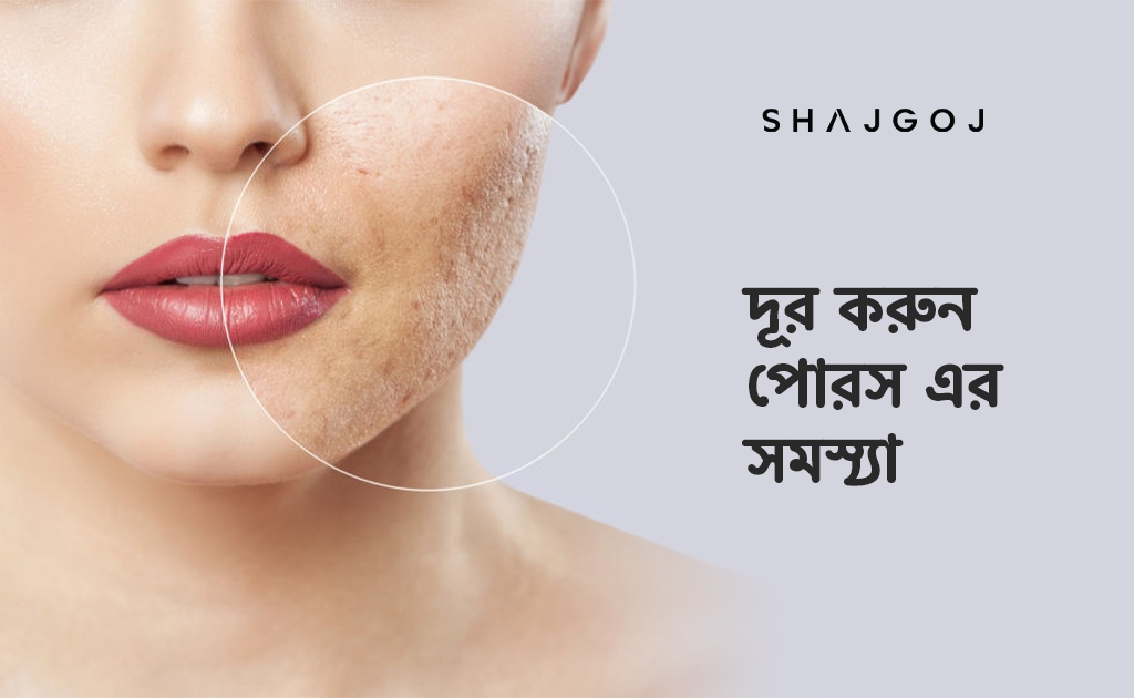 দূর করুন পোরস এর সমস্যা