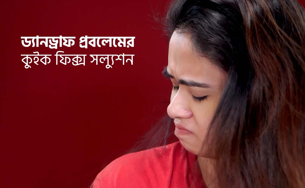 ড্যানড্রাফ প্রবলেমের কুইক ফিক্স সল্যুশন