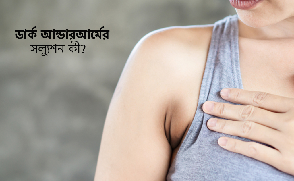 ডার্ক আন্ডারআর্মের সল্যুশন কী?