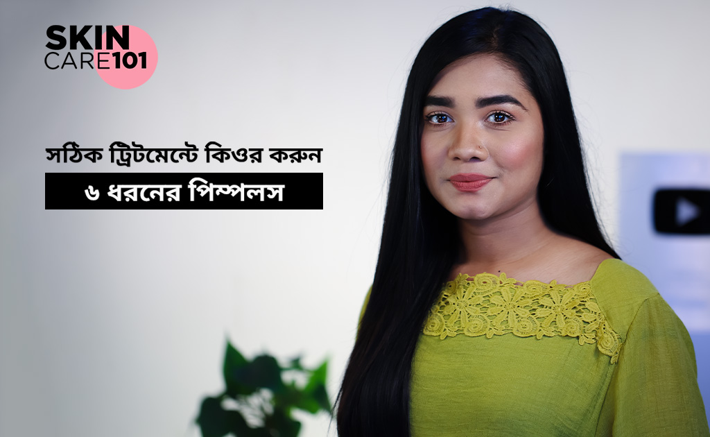 স্কিন কেয়ার ১০১| সঠিক ট্রিটমেন্টে কিওর করুন ৬ ধরনের পিম্পলস