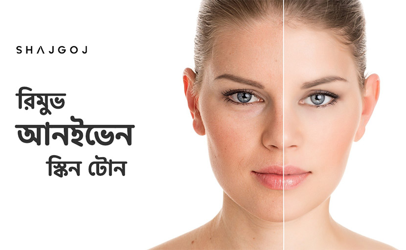 আনইভেন স্কিন টোন কিভাবে দূর করবেন?