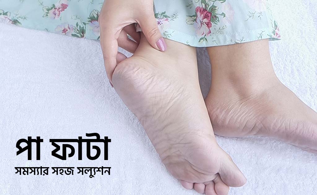 পা ফাটা সমস্যার সহজ সল্যুশন