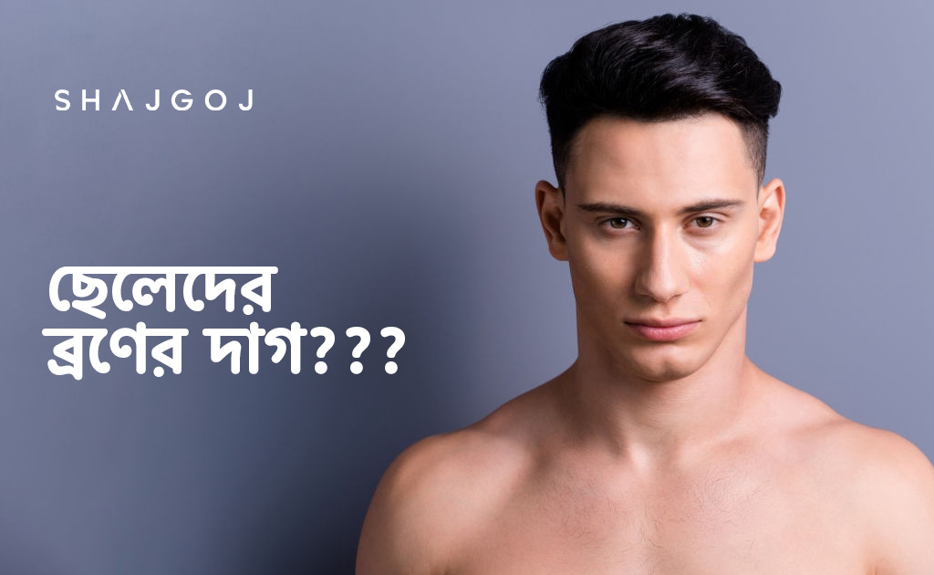 ছেলেদের মুখের ব্রণের দাগ দূর করার সহজ উপায়