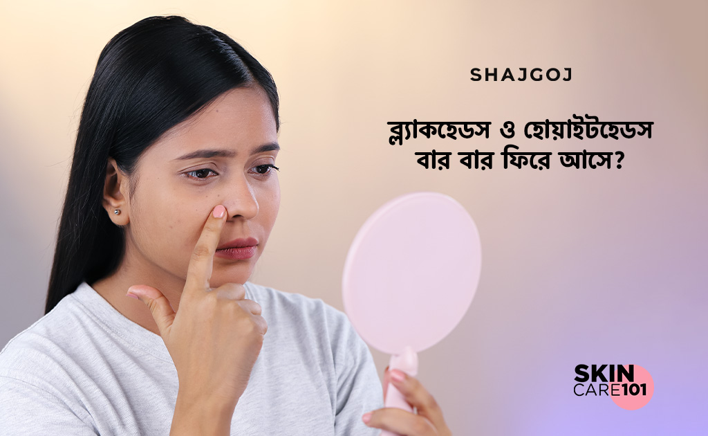 ব্ল্যাকহেডস ও হোয়াইটহেডস বার বার ফিরে আসে?