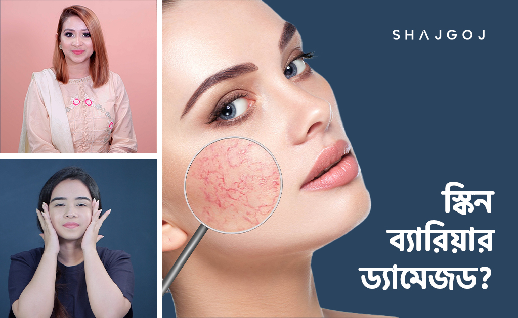 স্কিন ব্যারিয়ার ড্যামেজড?