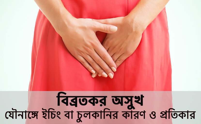 যৌনাঙ্গে ইচিং বা চুলকানি | অসুখটির কারণ, প্রতিকার ও প্রতিরোধ জানেন কি?
