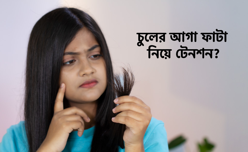 চুলের আগা ফাটা নিয়ে টেনশন?