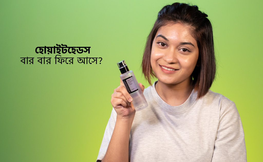 হোয়াইটহেডস বার বার ফিরে আসে?