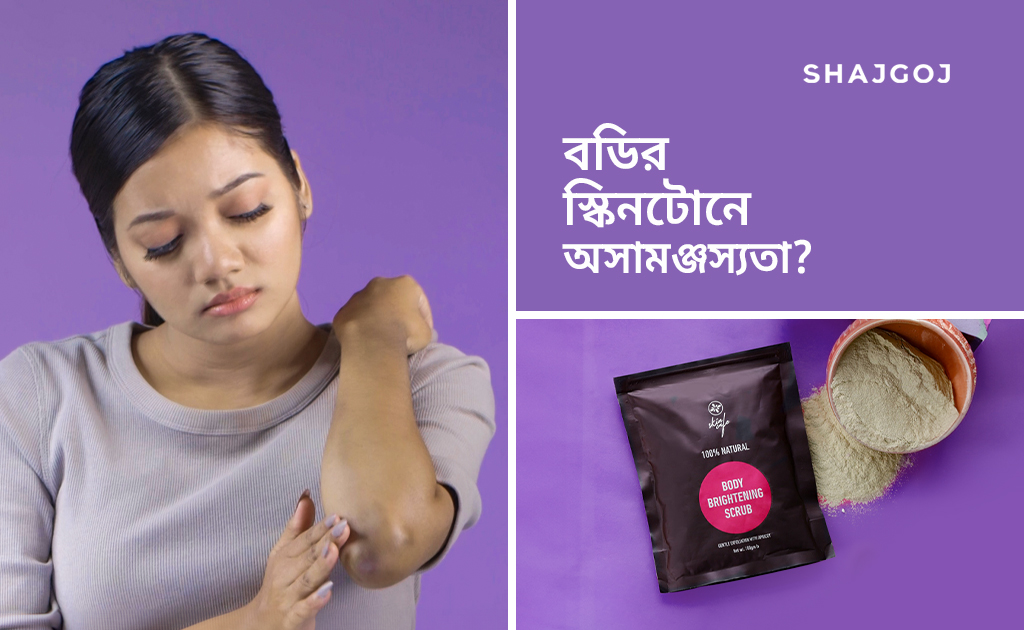 বডির স্কিনটোনে অসামঞ্জস্যতা?