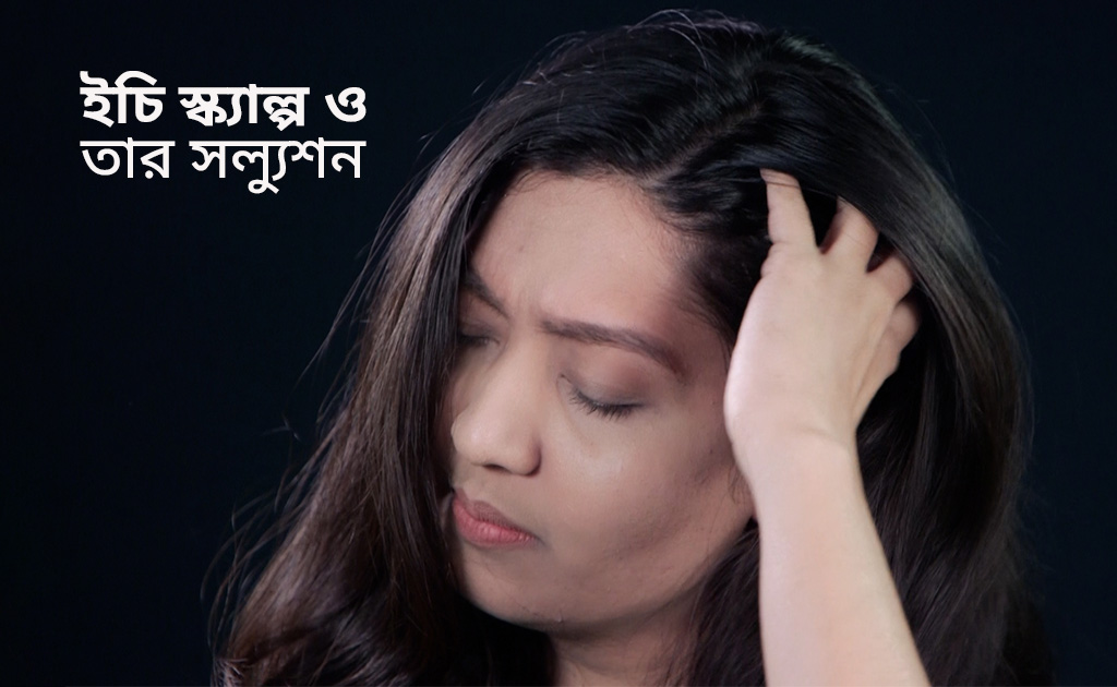 ইচি স্ক্যাল্প ও তার সল্যুশন