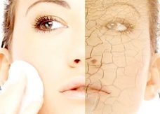 dry-skin-face