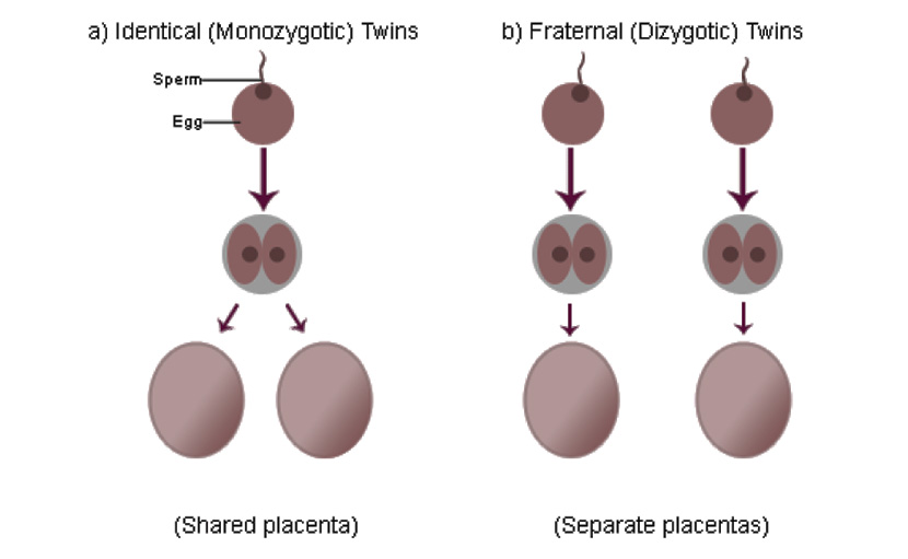 Identical ও Fraternal টুইন বেবি placenta - shajgoj.com