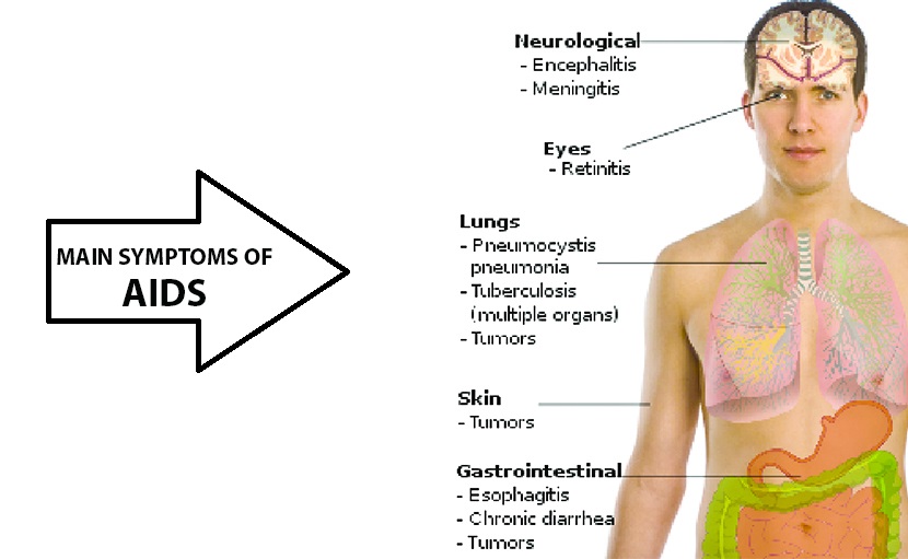 এইডস (AIDS) এর মেইন সিম্পটম - shajgoj