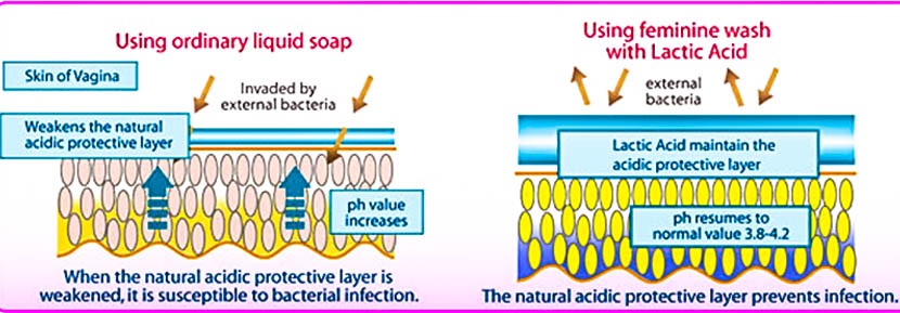 ভ্যাজাইনাতে সাবান, স্প্রে ব্যবহার করলে এর ph level, অ্যাসিডিটি দুর্বল হয়ে ইনফেকশন দেখা দেয় - shajgoj.com