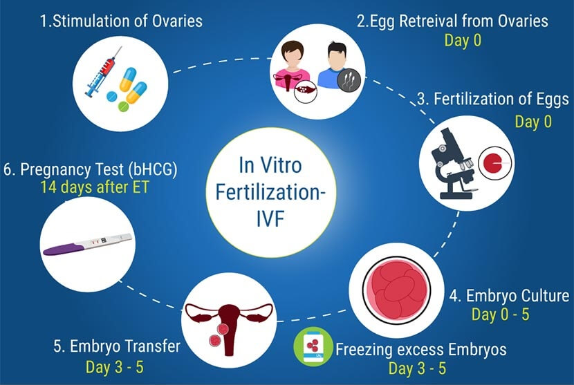 টেস্ট টিউব বেবি নিতে ইন ভিট্রো ফার্টিলাইজেশন - shajgoj.com