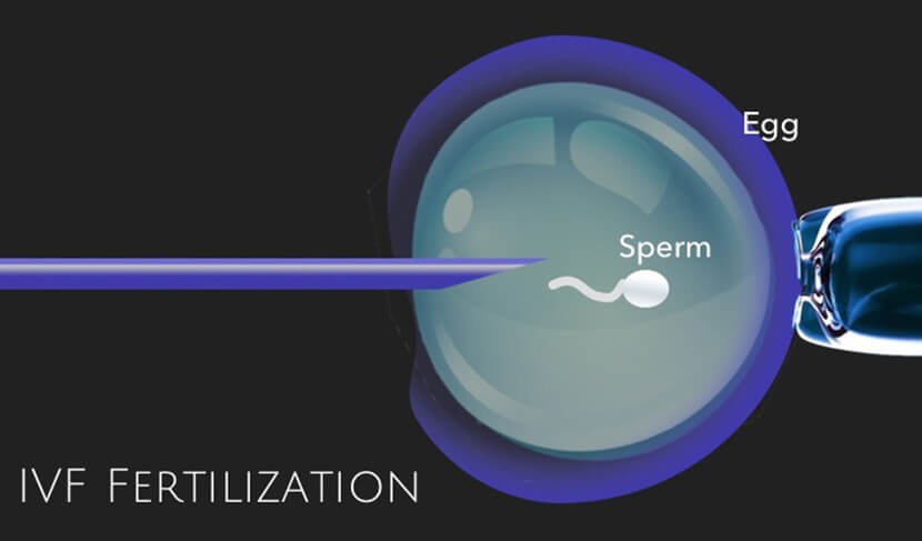 টেস্ট টিউব বেবি নিতে আইভিএফ ফার্টিলাইজেশন পদ্ধতি - shajgoj.com