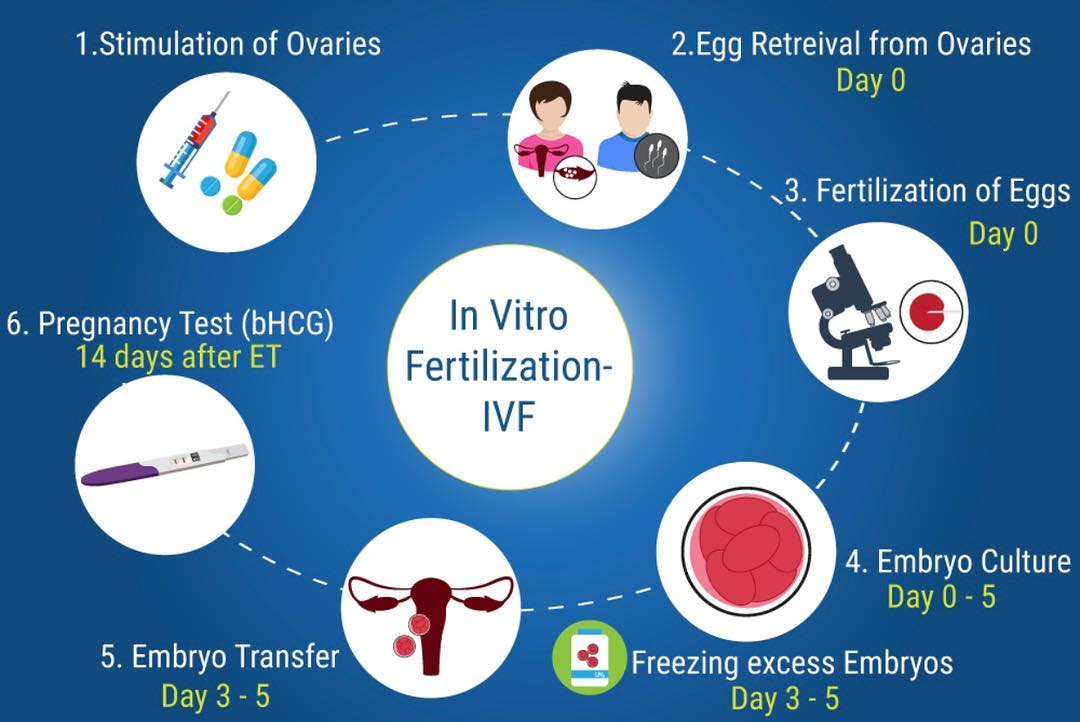 ইনফার্টিলিটি তে IVF (টেস্ট টিউব বেবী) - shajgoj.com