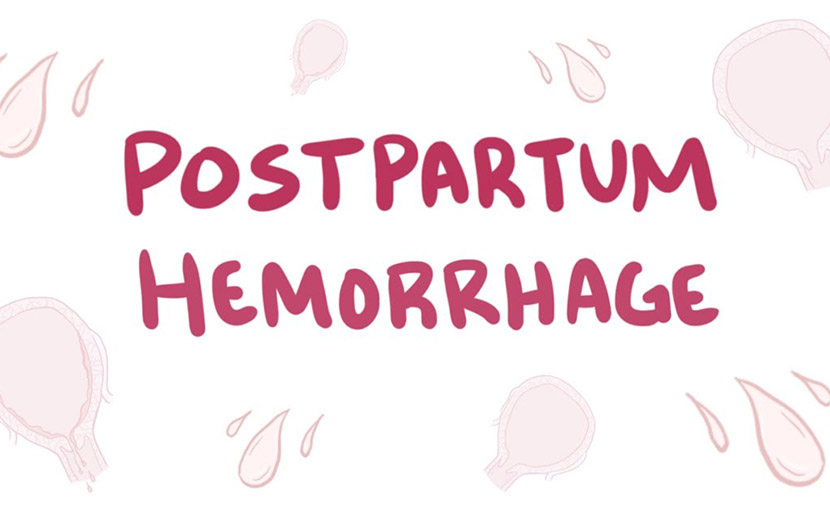 সিজার পরবর্তী জটিলতা Postpartum hemorrhage - shajgoj.com