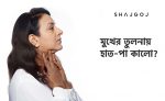 মুখের তুলনায় হাত পা কালো - shajgoj.com