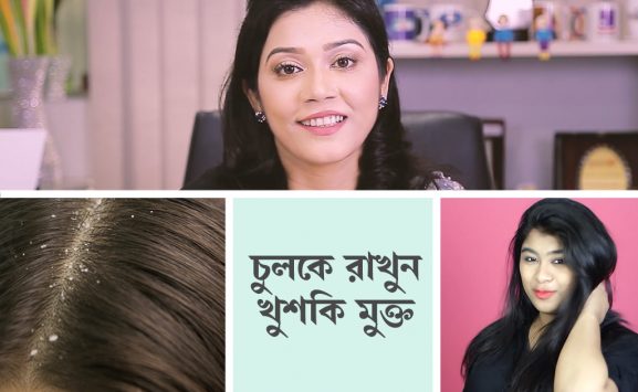 চুলকে রাখুন খুশকি মুক্ত _ Keep your hair Dandruff free