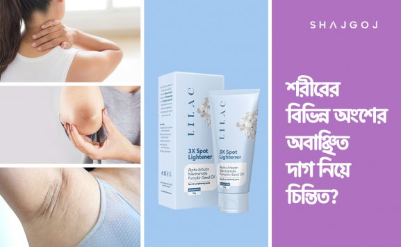 শরীরের বিভিন্ন অংশের অবাঞ্ছিত দাগ নিয়ে চিন্তিত-blog thumbnail